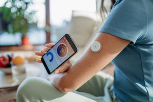 Medidor de Glucosa Continuo o CGM